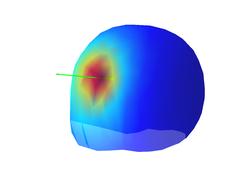 The topography, location and orientation of the first EEG source 